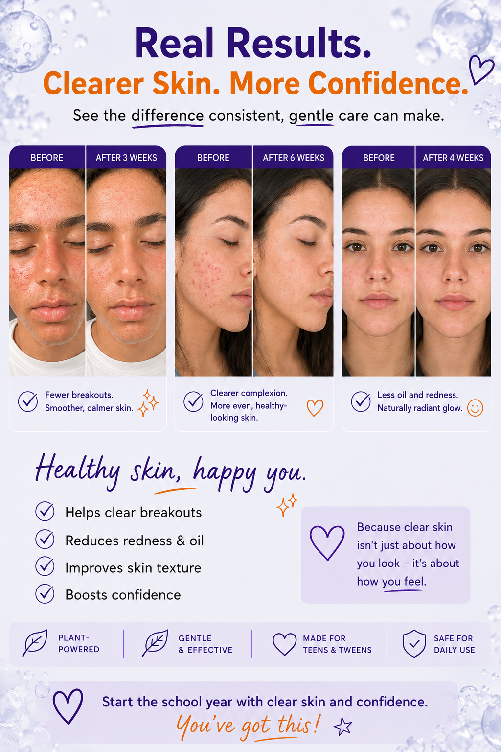 Clear Complexion Acne Kit